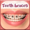 Teeth Braces Photo Editor & Stickers: Dentist Game
