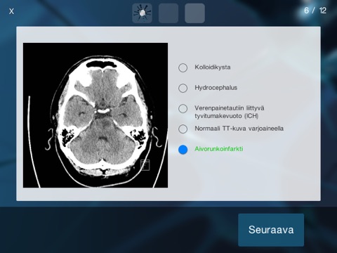 Neuropeli screenshot 2