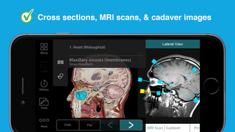 Human Anatomy Atlas - 3D Anatomical Model Body