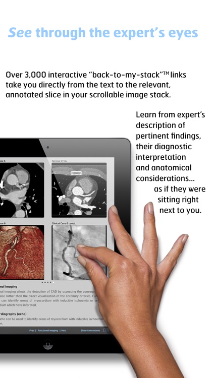 Radiology - Fundamentals of Thoracic Imaging screenshot-3