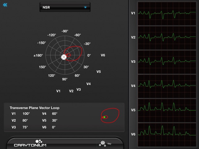 Craytonium ECG(圖5)-速報App