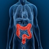 How to Prevent Colorectal Cancer-Treatment Guide