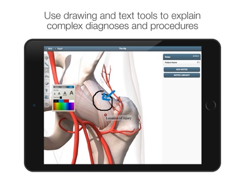 The Visual Consult: Hip Replacement screenshot 2