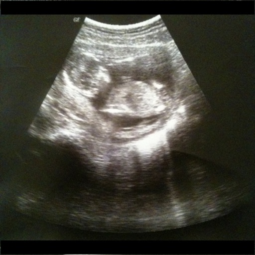 Full Term - Labor Contraction Timer, Pregnancy Reference & Kick Counter