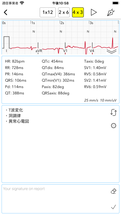 ECG Test Pro screenshot1