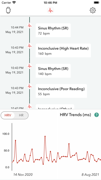 ECG Analyzer for HRV