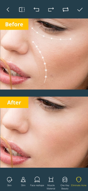 ‎Photo Retouch-Object Removal Screenshot