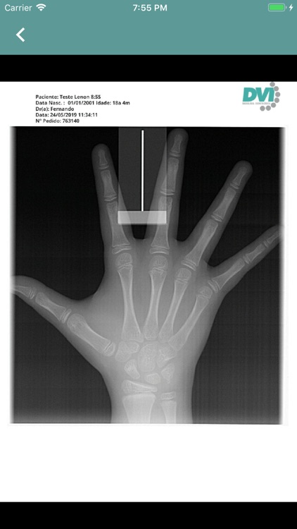 DVI Radiologia Odontológica screenshot-3