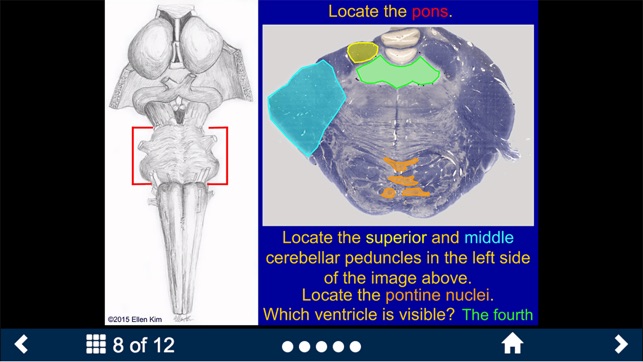 Neuroanatomy Lite - SecondLook(圖5)-速報App