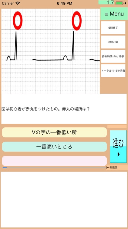 なんちゃって心電図全集(総集編):Drアニメ150問 screenshot-7