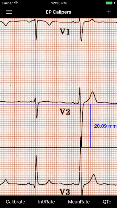 EP Calipers Screenshot 6