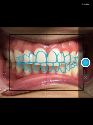 Invisalign Photo Uploader screenshot 3