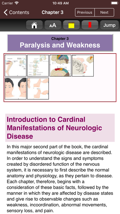 Adams & Victor's Neurology 11e screenshot 4