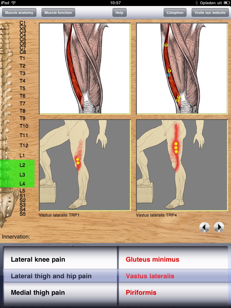 Dry Needling Pro screenshot 4