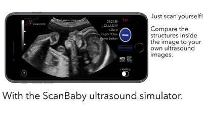 ScanBaby learn baby ultrasound screenshot 2