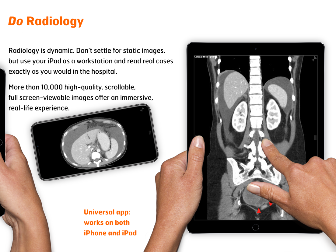 Radiology Abdomen Dynamic App voor iPhone, iPad en iPod touch