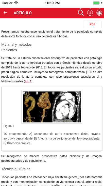 Cirugía Cardiovascular