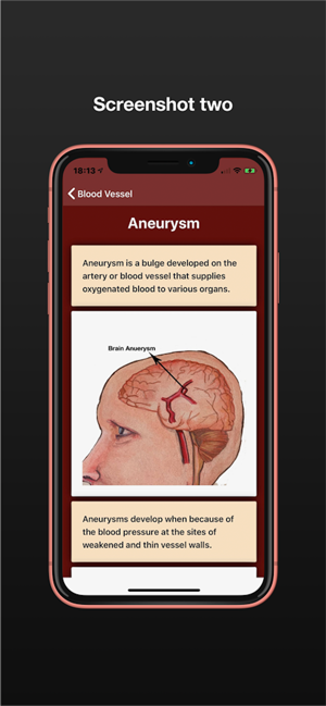 Neuro Surgery SPp(圖2)-速報App