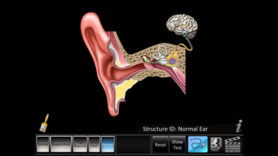 How to cancel & delete Otitis Media Disorders from iphone & ipad 1