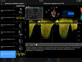 Game screenshot CARDIO3®Echocardiography HD mod apk