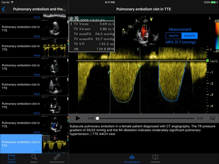 【图】CARDIO3®Echocardiography HD(截图1)