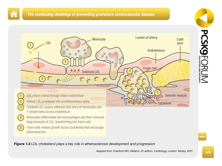 PCSK9 Forum: Lipid Lowering