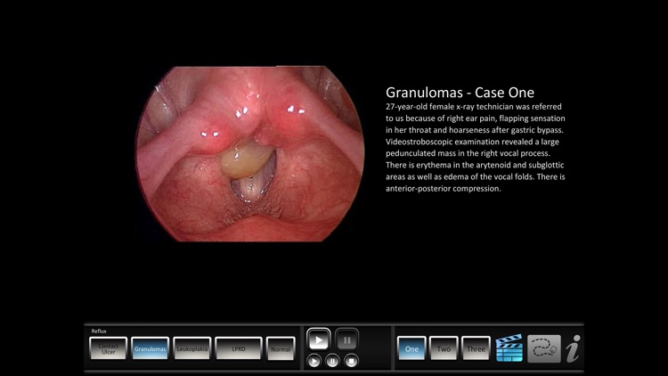 Vocal Pathology: Reflux screenshot-3