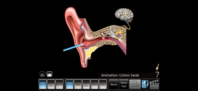 Ear Disorders: Outer Middle(圖1)-速報App