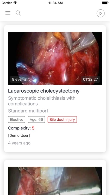 Theator Surgical Intelligence
