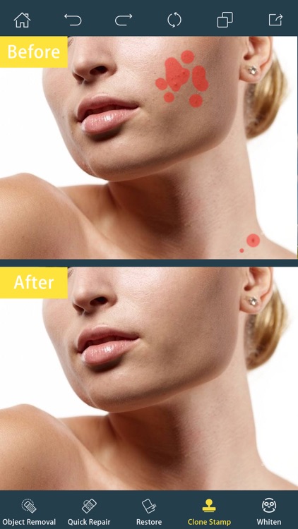 Photo Retouch- Blemish Remover