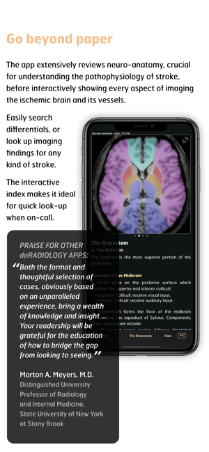 Radiology - Imaging in Stroke(圖2)-速報App