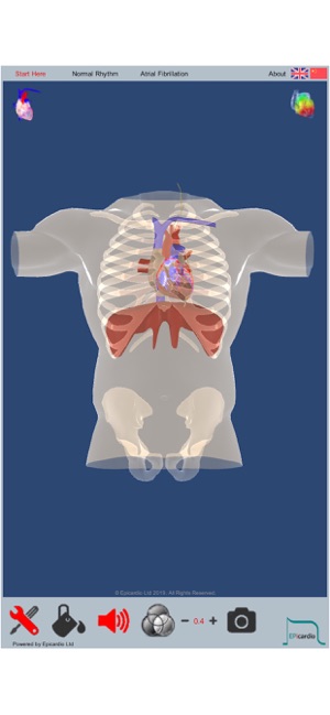 Intelligent Heart Sim AFib