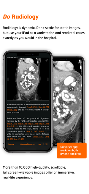 Radiology - Abdomen Dynamic(圖3)-速報App