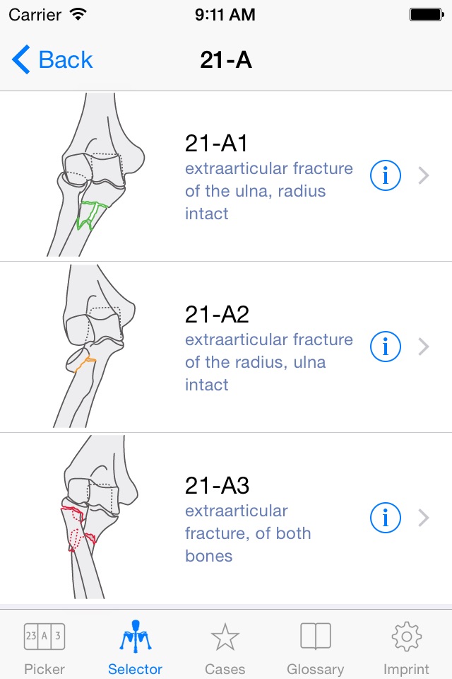 AO/OTA Fracture Classification screenshot 2