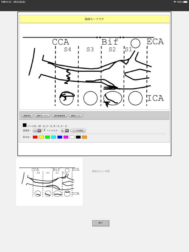 US-carotid(圖5)-速報App