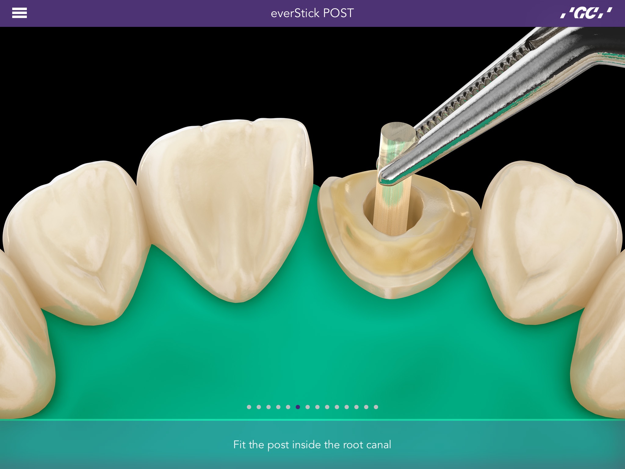 GC Restorative Dentistry screenshot 4