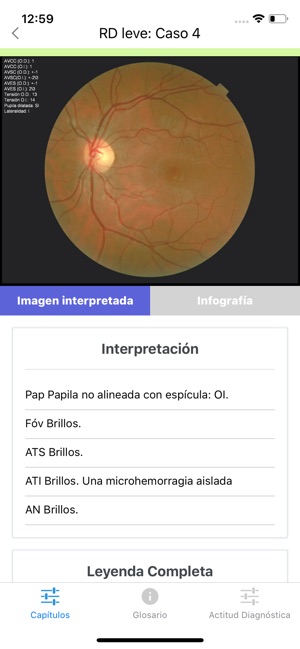 ATLAS Retinopatía Diabética(圖3)-速報App