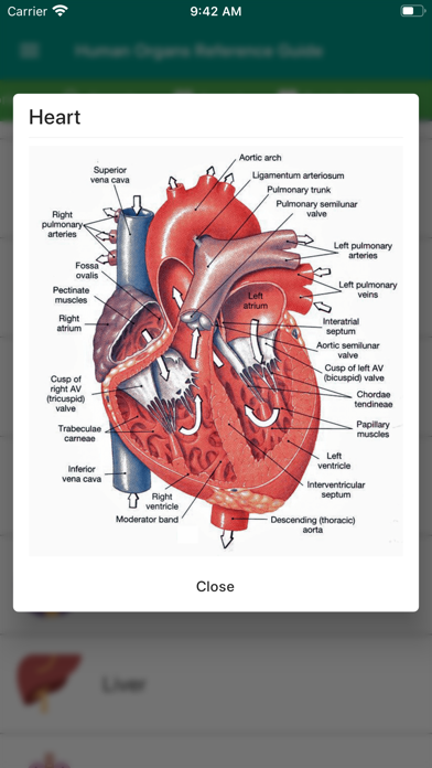 How to cancel & delete Human Organs Anatomy Reference from iphone & ipad 3