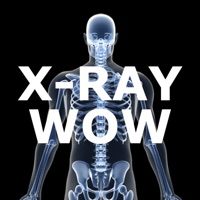 X-Ray Wow apk