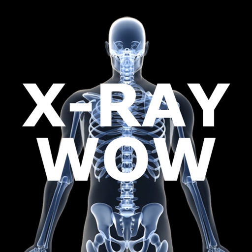 X-Ray Wow