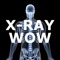 A collection of authentic x-ray images of 20 patients who have experienced serious trauma or unusual surgical procedures