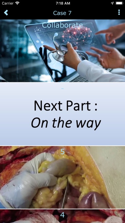Autopsy