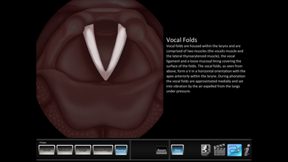 How to cancel & delete Vocal Pathology: Polyps from iphone & ipad 4