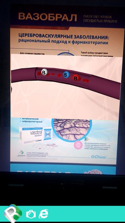 Vasobral-VS-CVD