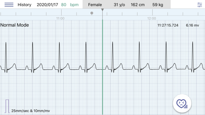 Q-ecg screenshot 2