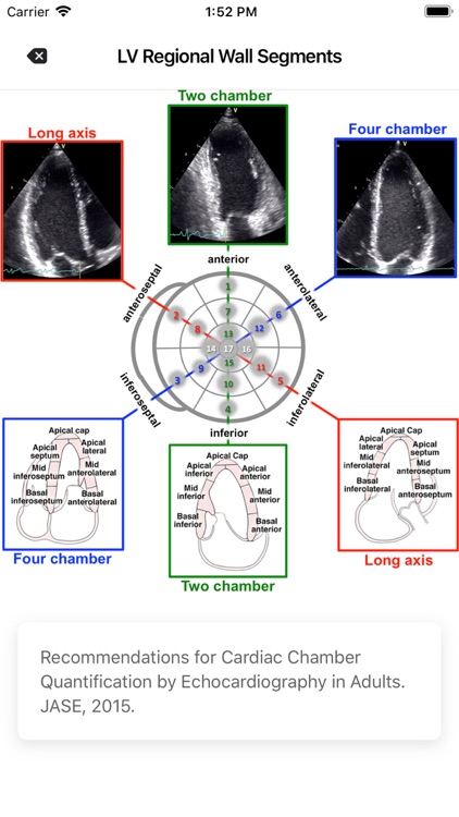 Cardio Guide screenshot-5