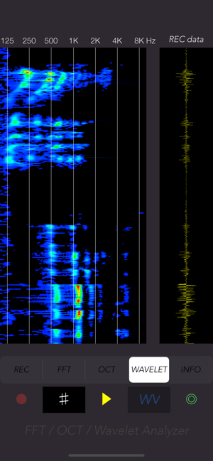 Voice Sonogram