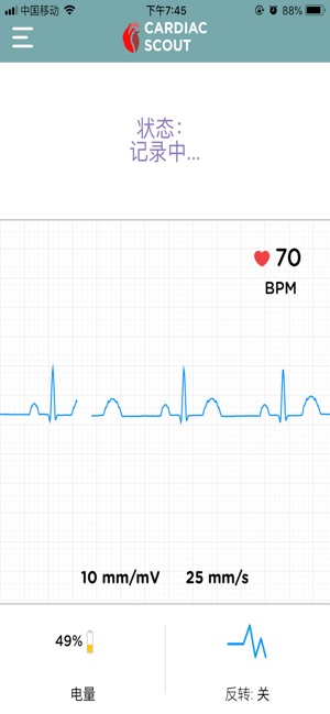 Cardiac Scout