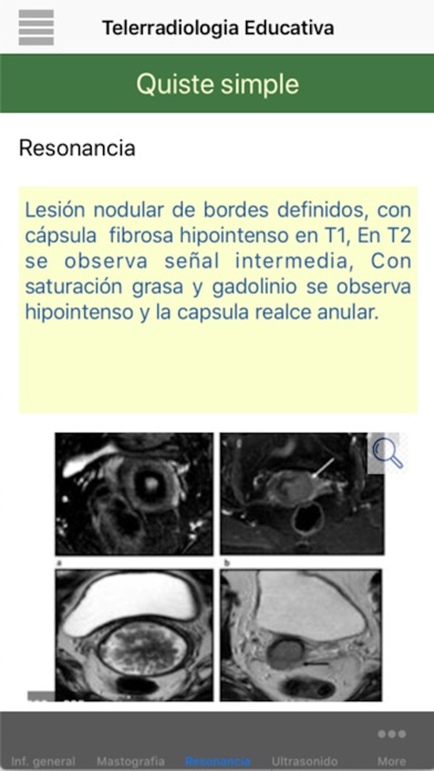 Telerradiología -Educativa screenshot 4