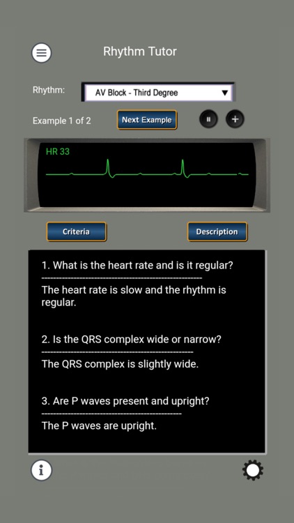 ECG Rhythms and ACLS Cases